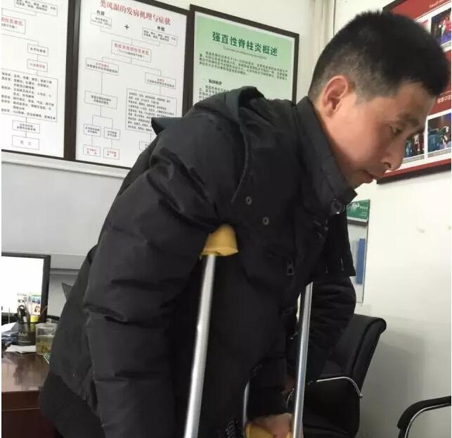 成都京研强直性脊柱炎研究院